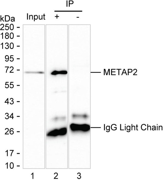 Anti-METAP2