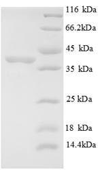 E3 ubiquitin-protein ligase MIB1 (MIB1), partial, human, recombinant