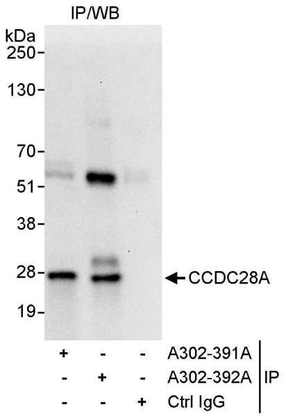 Anti-CCDC28A