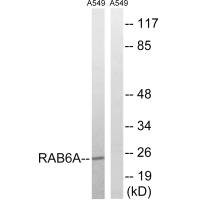 Anti-RAB6A