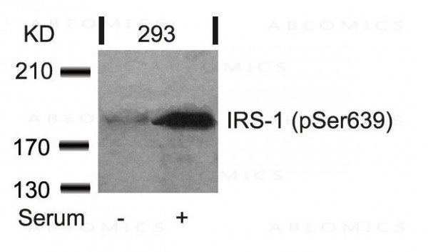 Anti-phospho-IRS-1 (Ser639)