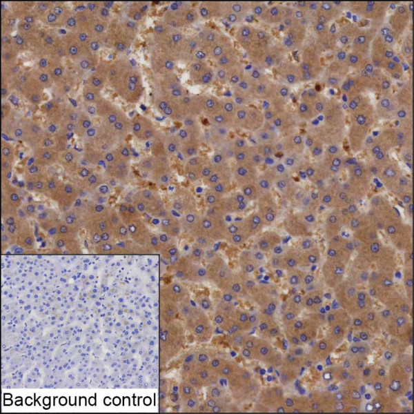 Anti-SULT1A1