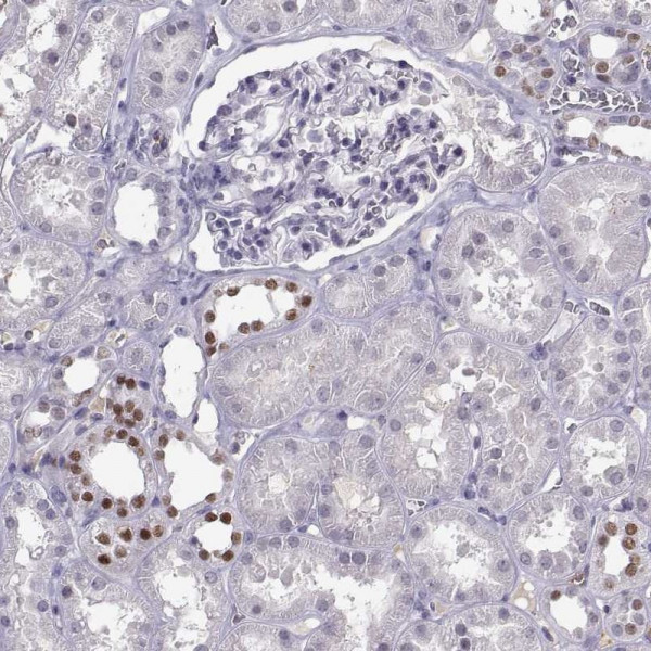 Anti-LHX1