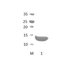 GOPC PDZ Domain