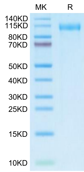 SARS-CoV-2 Spike S1 (Omicron BA.2.12.1) Protein