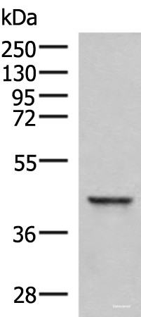 Anti-SAMSN1
