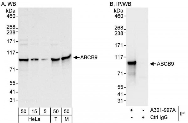 Anti-ABCB9