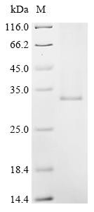 Very long chain fatty acid elongase 5 (ELOVL5), recombinant human