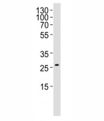Anti-NRG1