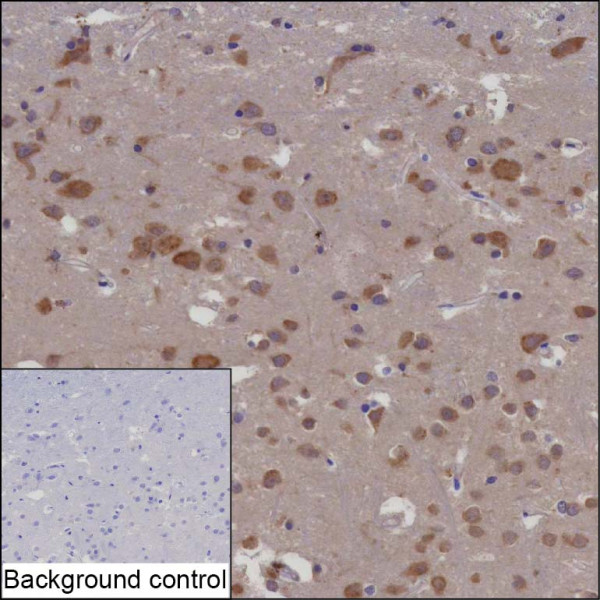 Anti-DLGAP4