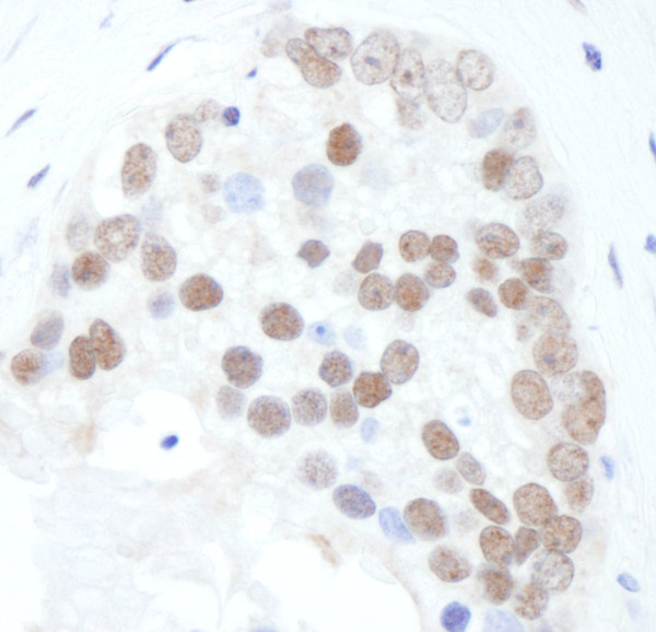 Anti-phospho-XRCC1 (Ser518/Thr519/Thr523)