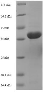 Aculeacin-A acylase (aac), partial, Actinoplanes utahensis, recombinant