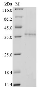 Non-structural protein 2a (2a), Bovine coronavirus, recombinant