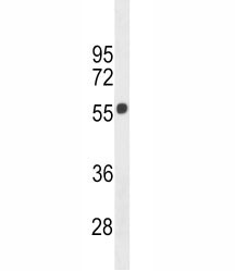 Anti-Cannabinoid Receptor 1