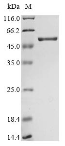 SARS coronavirus Nucleoprotein (N), human, recombinant