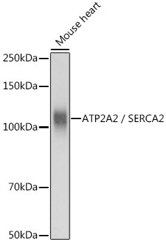 Anti-ATP2A2