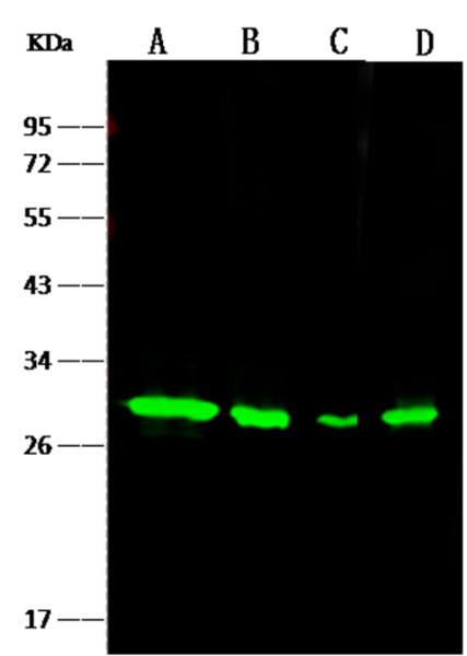 Anti-NQO1 Monoclonal Recombinant Antibody