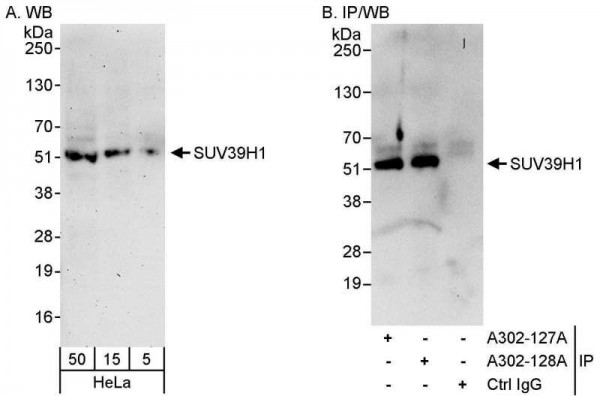 Anti-SUV39H1