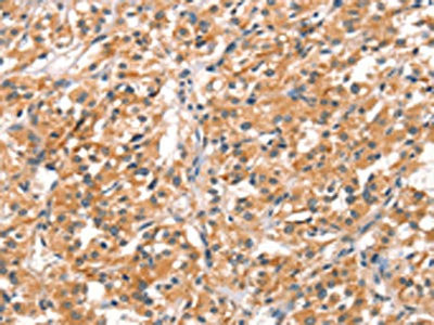 Anti-RHOBTB2
