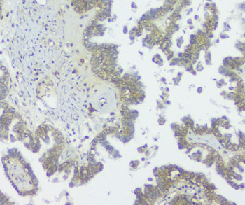 Anti-GNAQ / Guanine nucleotide binding protein Gq subunit alpha, clone 13H4