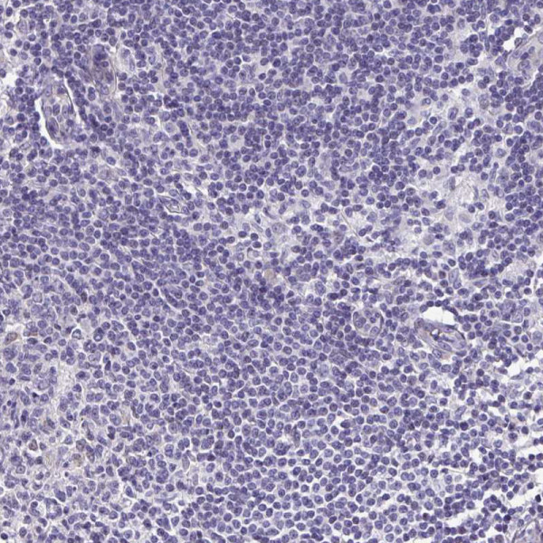 Anti-TGM3