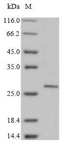 Sclerostin domain-containing protein 1 (Sostdc1), rat, recombinant