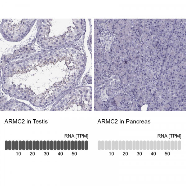 Anti-ARMC2