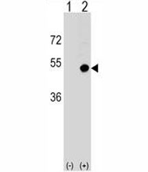 Anti-CD1d