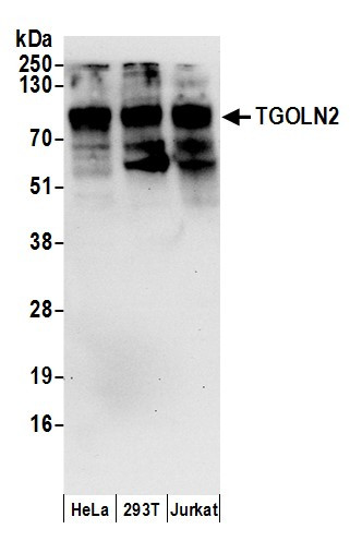 Anti-TGOLN2