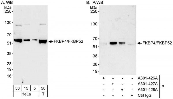 Anti-FKBP4/FKBP52