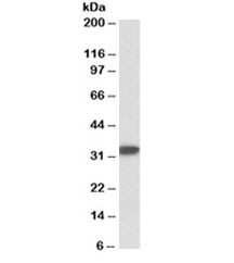Anti-CD74
