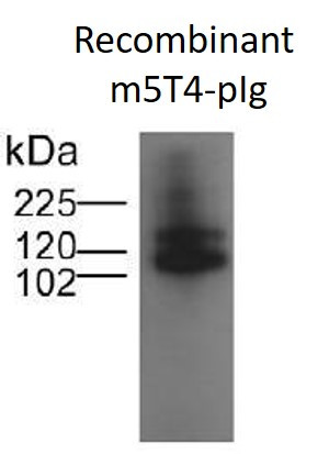 Anti-5T4, clone B3F1