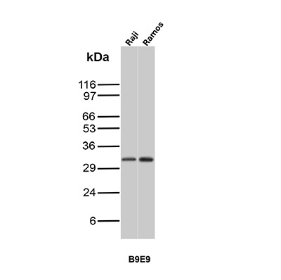 Anti-CD20 / MS4A1 (B-Cell Marker), clone B9E9