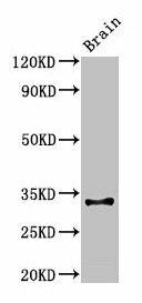 Anti-Cd74