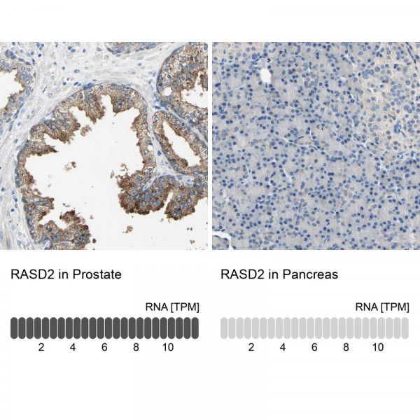 Anti-RASD2