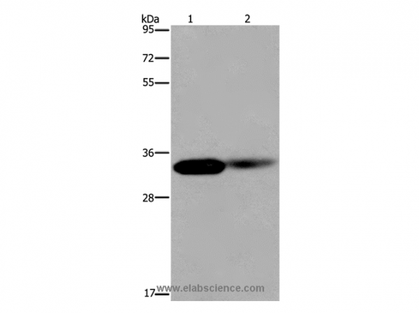 Anti-LIMS1