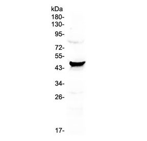 Anti-CCN3 / NOV / IGFBP9 (C-Terminal Region)