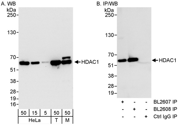 Anti-HDAC1
