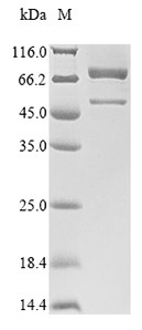 Peroxisomal acyl-coenzyme A oxidase 1 (Acox1), mouse, recombinant