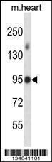 Anti-Mlk4, ID (Mlk4, Kiaa1804, Mitogen-activated protein kinase kinase kinase MLK4, Mixed lineage ki