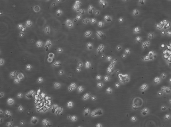 B-LCL-CDG3 Cells