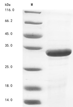 Matrix protein VP40 (VP40), Zaire ebolavirus, recombinant
