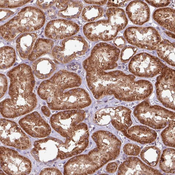 Anti-OXER1