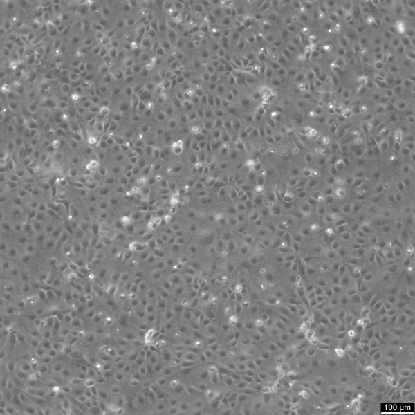 HCE-T Cells