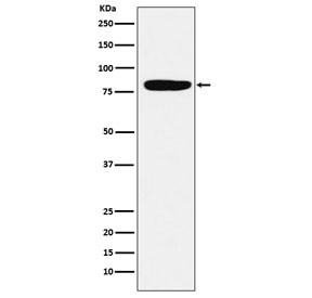 Anti-Factor XIIIa / F13A1, clone ACGC-6