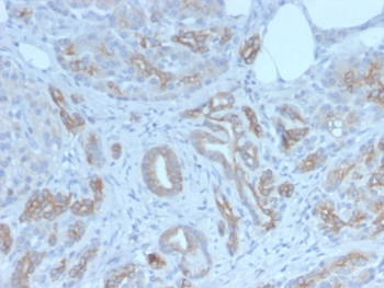 Anti-Golgi / GLG1, clone GLG1/7174R