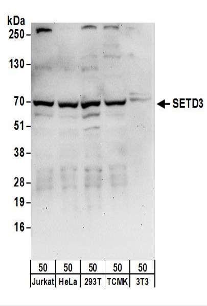 Anti-SETD3