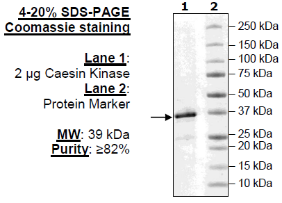 Casein Kinase 1alpha1
