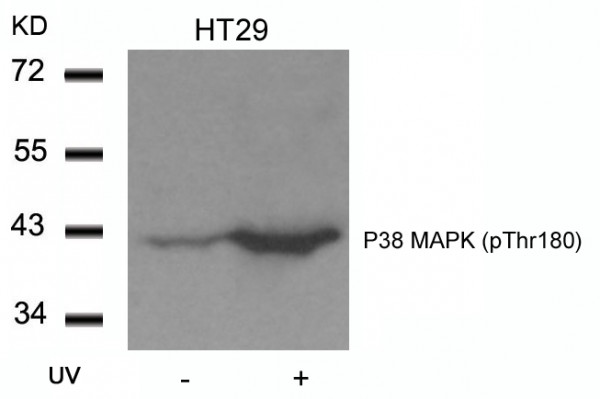 Anti-phospho-P38 MAPK (Thr180)