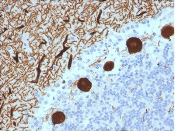 Anti-CA8 / Carbonic Anhydrase VIII, clone CPTC-CA8-2